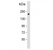 Western blot testing of human SK-BR-3 cell lysate with ErbB2 antibody. Expected molecular weight: 139-185 kDa depending on glycosylation level.