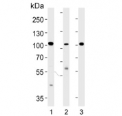 Western blot testing of 1) human Hela, 2) human MDA-MB-453 and 3) mouse kidney lysate with NCOA7 antibody. Predicted molecular weight ~106 kDa, may be observed at 120~140 kDa.
