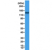 Western blot testing of human Jurkat cell lysate with recombinant CD31 antibody at 1:1000. Expected molecular weight: 83-130 kDa depending on level of glycosylation.