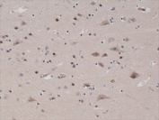 IHC testing of FFPE human brain tissue with recombinant PTEN antibody at 1:1000. 