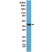 Western blot testing of human HeLa lysate with recombinant Vimentin antibody at 1:400 dilution. Predicted molecular weight ~53 kDa.