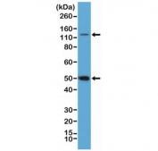 Western blot testing of HeLa cell lysate with recombinant NFKB1 antibody at 1:100 dilution. Expected molecular weight: 50 kDa / 105 kDa.