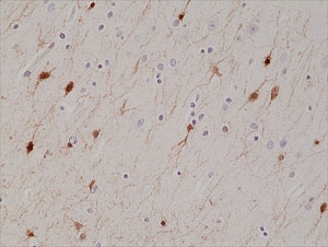 IHC staining of FFPE human brain tissue with recombinant Calretinin antibody at 1:1000.