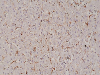 IHC staining of FFPE human liver tissue with recombinant Caveolin-1 antibody at 1:1000.~
