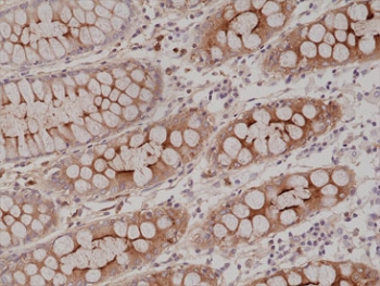 IHC staining of FFPE human colon tissue with recombinant CEA antibody at 1:20