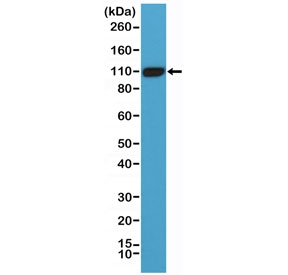 Western blot testing of human LNCaP cell lysate with recombinant PSMA antibody at 1:1000. Predicted molecular weight ~100 kDa.~