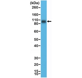 Western blot testing of human LNCaP cell lysate with recombinant CD276 antibody at 1:10,000 dilution. Expected molecular weight: 57-110 kDa depending on level of glycosylation.~