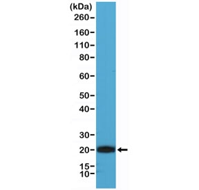 Western blot testing of human Jurkat cell lysate with recombinant CD3 epsilon antibody at 1:1000. Predicted molecular weight ~23 kDa.~