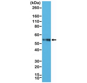 Western blot testing of human Jurkat cell lysate with recombinant CD4 antibody at 1:2500. Expected molecular weight: 50-55 kDa.~