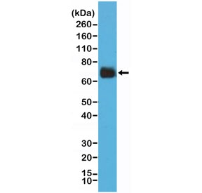 Western blot testing of human HeLa cell lysate with recombinant Cyclooxygenase 2 antibody at 1:2000 dilution. Predicted molecular weight ~69 kDa.~