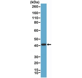 Western blot testing of human LNCaP cell lysate with recombinant AMACR antibody at 1:1000 dilution. Predicted molecular weight ~43 kDa.~