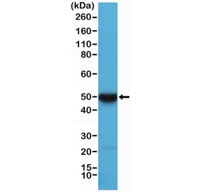 Western blot testing of human HeLa cell lysate with recombinant Cytokeratin 17 antibody at 1:10,000 dilution.~