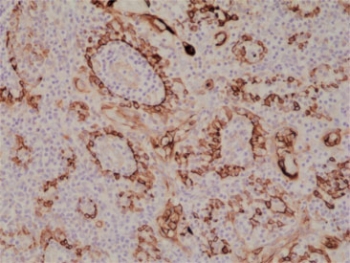 IHC staining of FFPE human tonsil tissue with recombinant Cytokeratin 17 antibody at 1:1000.