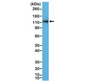 Western blot testing of human A431 cell lysate with recombinant p120-Catenin antibody at 1:500 dilution. Predicted molecular weight of ~108 kDa but commonly observed at 66-120 kDa (multiple isoforms).~