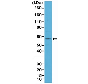 Western blot testing of human A431 cell lysate with recombinant KRT4 antibody at 1:100 dilution.~