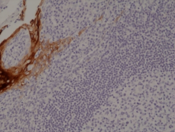 IHC staining of FFPE human tonsil tissue with recombinant KRT4 antibody at 1:1000.