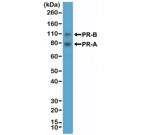 Western blot testing of human T-47D cell lysate with recombinant PR antibody at 1:2000 dilution. Expected molecular weight: 82-94 kDa (PR-A) and 99-120 kDa (PR-B).~