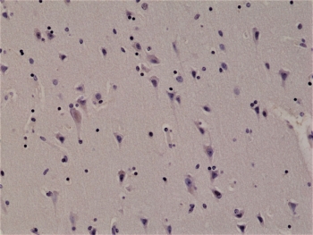 IHC staining of FFPE human brain tissue with recombinant ALK antibody at 1:1000.