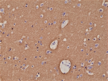 IHC staining of FFPE human brain tissue with recombinant STX1A antibody at 1:1000.