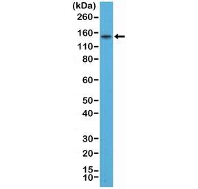 Western blot testing of human TT cell lysate with recombinant Thyroid Peroxidase antibody at 1:200. Predicted molecular weight ~103 kDa but may be observed at higher molecular weights due to glycosylation.~