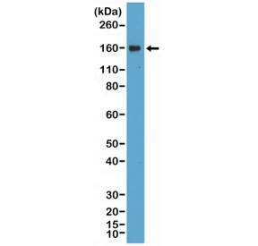 Western blot testing of human Daudi cell lysate with recombinant CD21 antibody at 1:400 dilution. Predicted molecular weight ~113 kDa but may be observed at higher molecular weights due to glycosylation.~