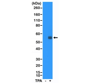 Western blot testing of lysate from HeLa cells, non-treated (-)or treated (+) with TPA, with recombinant c-Fos antibody at 1:5000 dilution. Expected molecular weight: ~40 kDa (unmodified), 53-68 kDa (phosphorylated).~