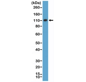 Western blot testing of human HeLa cell lysate with recombinant MSH2 antibody at 1:1000 dilution. Expected molecular weight ~105 kDa.~
