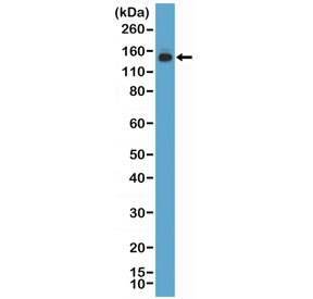 Western blot testing of human HEK293 cell lysate with recombinant MSH6 antibody at 1:1000 dilution. Expected molecular weight: 120-160 kDa depending on phosphorylation level.~