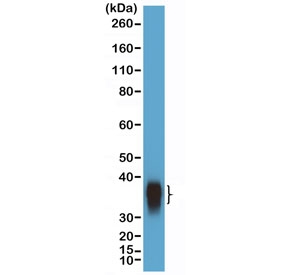 Western blot testing of human Daudi cell lysate with recombinant BOB-1 antibody at 1:10,000 dilution. Predicted molecular weight: ~28 kDa (unmodified), 35-40 kDa (ubiquitinated).~
