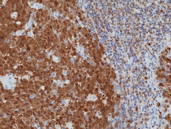 IHC staining of FFPE human tonsil tissue with recombinant