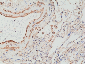 IHC staining of FFPE human lung tissue with recombinant MMP12 antibody at 1:2500.~