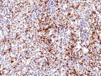 IHC staining of FFPE human spleen tissue with recombinant CD61