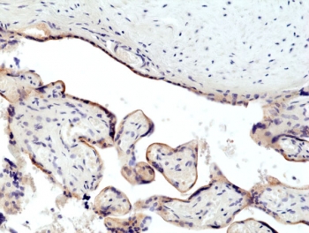 IHC staining of FFPE human placental tissue with recombinant Transferrin Receptor antibody at 1:500.