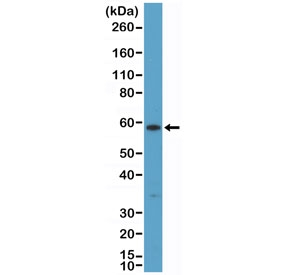 Western blot testing of human A431 cell lysate with recombinant Cytokeratin 10 antibody at 1:200 dilution. Predicted molecular weight ~59 kDa.~