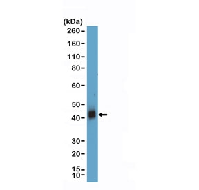 Western blot testing of human Jurkat cell lysate with recombinant CD38 antibody at 1:1000 dilution. Expected molecular weight: 34-46 kDa depending on glycosylation level.~