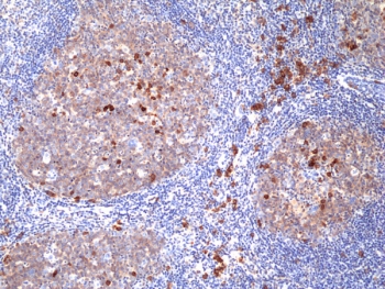 IHC staining of FFPE human tonsil tissue with recombinant CD38 an
