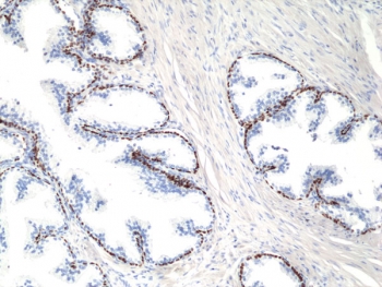 IHC staining of FFPE human prostate tissue with recombinant deltaNp63 antibody at 1:200.~