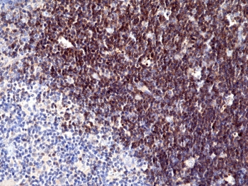 IHC staining of FFPE human thymus tissue with recombinant CD1a antibody at 1:100.~