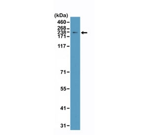 Western blot testing of human HeLa cell lysate with recombinant Topoisomerase II alpha antibody at 1:2000 dilution. Predicted molecular weight ~174 kDa.~