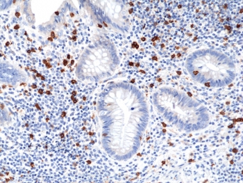 IHC staining of FFPE human appendix tissue with recombinant CD8a antibo