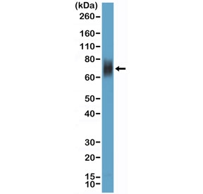 Western blot testing of human HL60 cell lysate with recombinant CD33 antibody at 1:100 dilution. Predicted molecular weight is 40-67 kDa depending on glycosylation level.~