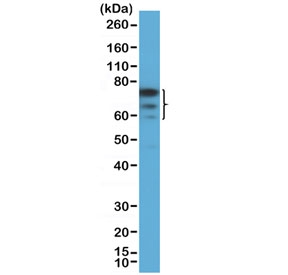 Western blot testing of human HEK293 cell lysate with recombinant FOXP1 antibody at 1:1000 dilution. Expected molecular weight: 65-77 kDa (multiple isoforms).~