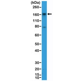 Western blot testing of human HepG2 cell lysate with recombinant CD13 antibody at 1:2000 dilution. Expected molecular weight: 110-150 kDa depending on glycosylation level.~