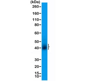 Western blot testing of human T-cell lysate with recombinant CD28 antibody at 1:200 dilution. Expected molecular weight depending on level of glycosylation: ~25-44 kDa (monomer), ~50-90 kDa (dimer).~