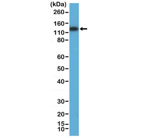 Western blot testing of human HEK293 cell lysate with recombinant MSH3 antibody at 1:800 dilution. Predicted molecular weight ~127 kDa.~