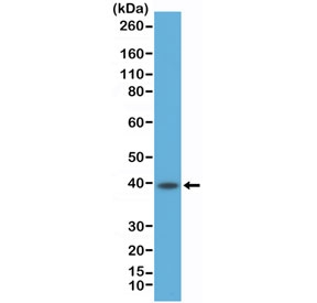 Western blot testing of human Raji cell lysate with recombinant CD23 antibody at 1:500 dilution. Expected molecular weight: 37~45 kDa.~