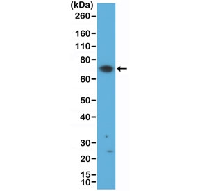 Western blot testing of human Jurkat cell lysate with recombinant ZAP70 antibody at 1:500 dilution. Predicted molecular weight ~70 kDa.~