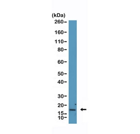 Western blot testing of human HEK293 cell lysate with recombinant p16INK4a antibody at 1:2000. Predicted molecular weight ~16 kDa.~