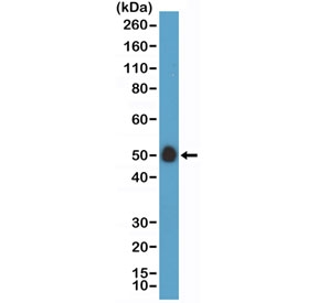 Western blot testing of human placenta lysate with recombinant CD14 antibody at 1:100 dilution. Predicted molecular weight: 40-55 kDa depending on glycosylation level.~