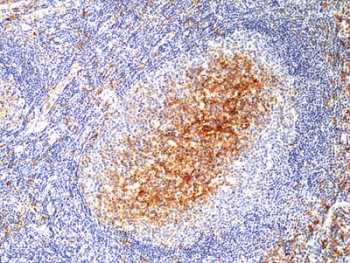 IHC staining of FFPE human tonsil tissue with recombinant CD14 antib